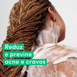 SABONETE DOVE LIQUIDO ACNE CONTROL 547ML